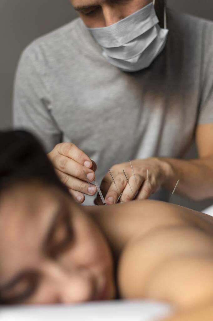 Espalda del paciente tiene en puntos principales del malestar agujas especiales de acupuntura
